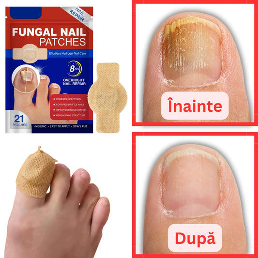 Plasturi pentru Unghii Sănătoase - ELAIMEI™